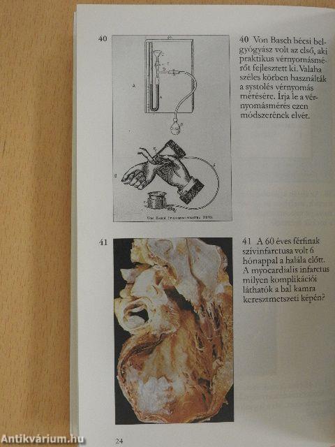 Hypertonia
