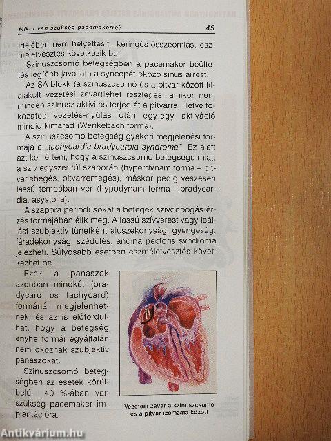 Amit a Pacemaker-ről tudni kell