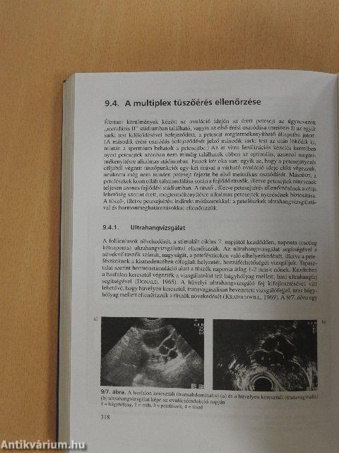 Nőgyógyászati endokrinológia