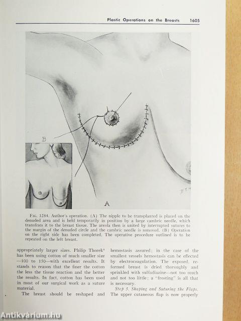 Modern Surgical Technic III.