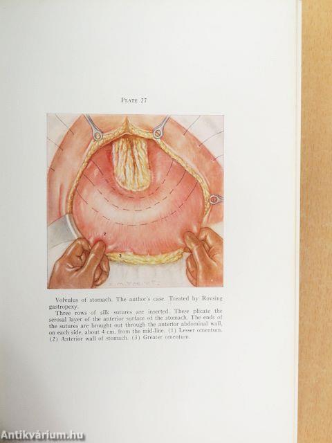 Modern Surgical Technic III.