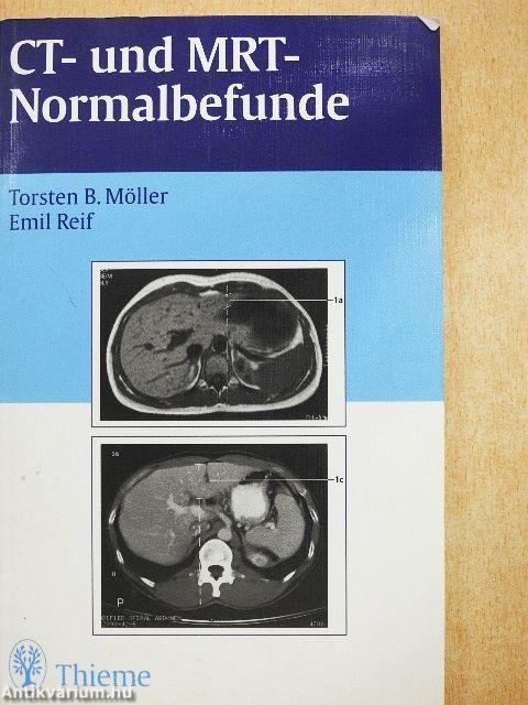 CT- und MRT-Normalbefunde