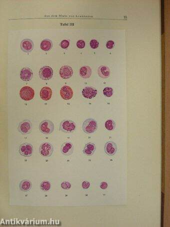 Atlas des normalen und pathologischen Knochenmarkes