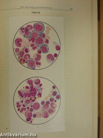 Atlas des normalen und pathologischen Knochenmarkes