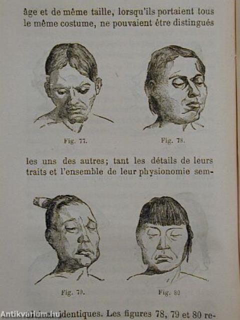 Physiognomonie et phrénologie