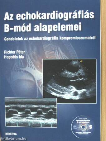 Az echokardiográfiás B-mód alapelemei - CD-vel