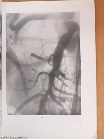 Magyar Radiologia 1976/2. Supplementum