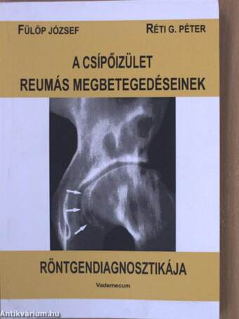 A csípőizület reumás megbetegedéseinek röntgendiagnosztikája