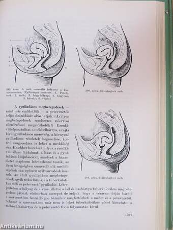 Az emberi test 2. (töredék)