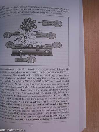 Optimális biszfoszfonát kezelés emlőrákban