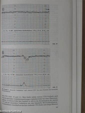 Deutschen Gesellschaft für Gynäkologie und Geburtshilfe/Dreiundvierzigste Versammlung Hamburg, 30. September bis 3. Oktober 1980