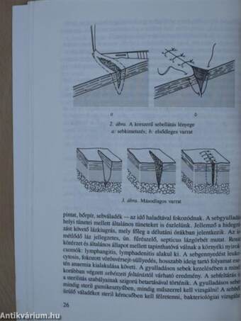 Klinikai ismeretek a sebészet köréből ápolónők részére