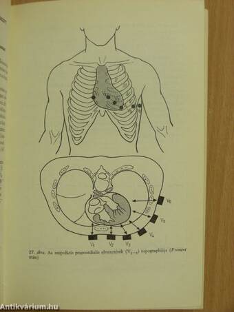 Electrocardiographia az orvosi gyakorlatban