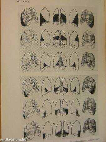 Bronchologia