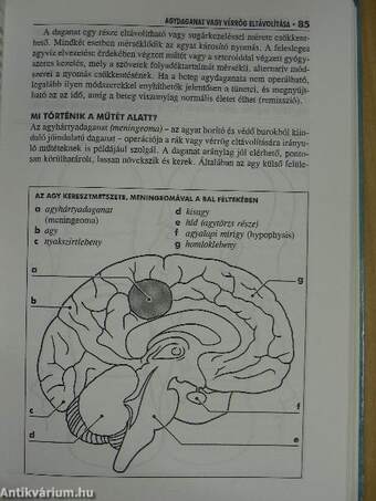 Műtét előtt, alatt és után