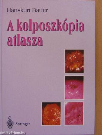 A kolposzkópia atlasza